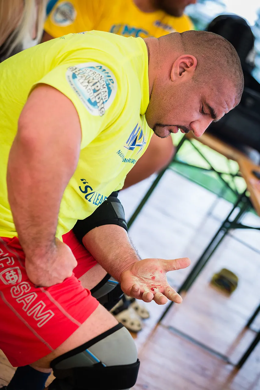 Závodník Strongman Champions League v pauze mezi disciplínami. Detail na otevřené rány a krev na dlani ruky, která je důsledkem extrémního tření a váhy při zvedání břemen.